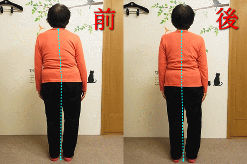 なごみ整体院 施術例
