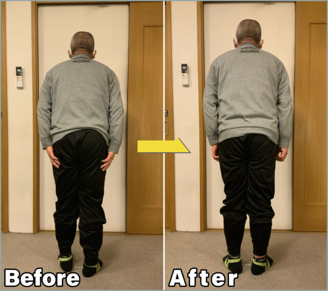 自律神経失調症Before&After01