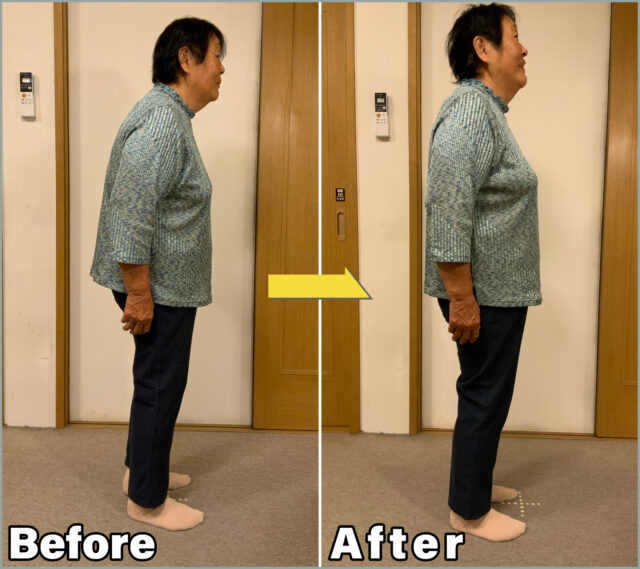 肩こりBefore＆After02