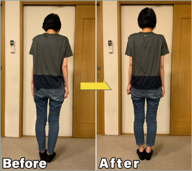 肩こりBefore＆After01